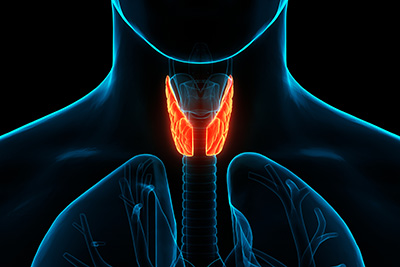 During Hashimoto's Thyroiditis the immune system attacks your thyroid gland